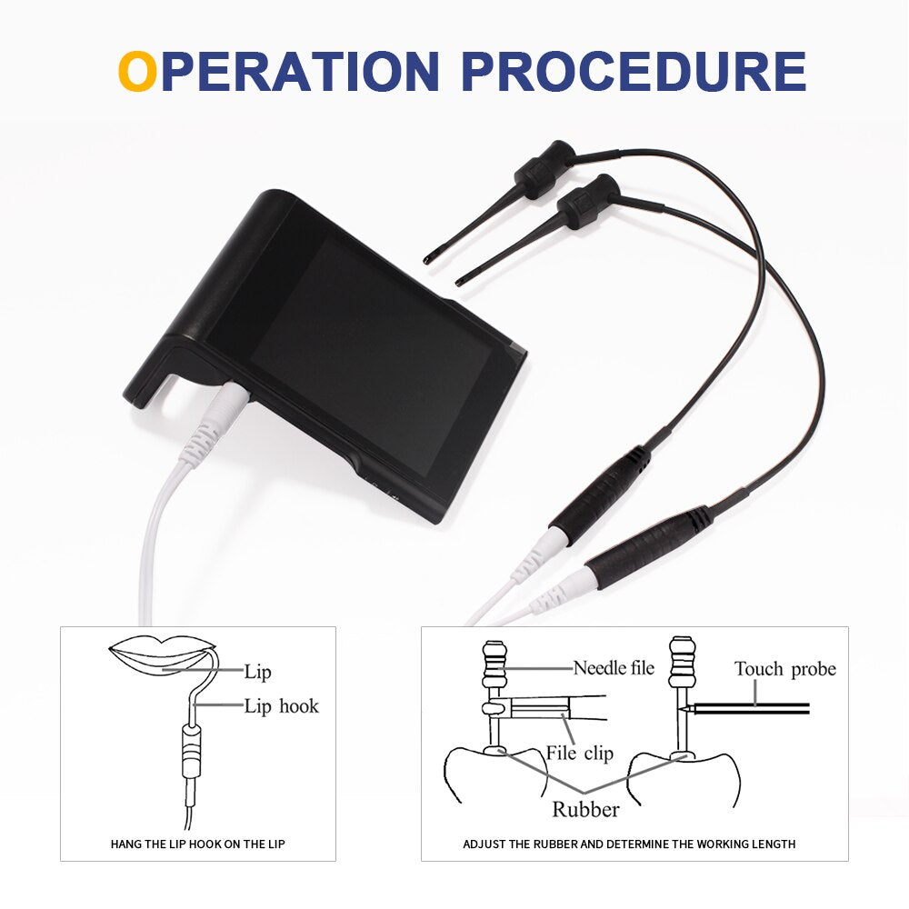 Zahnärztlicher Apex-Locator