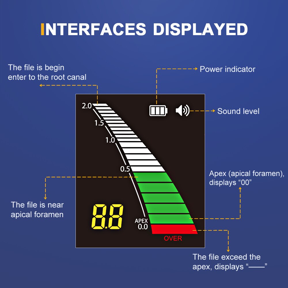 Zahnärztlicher Apex-Locator