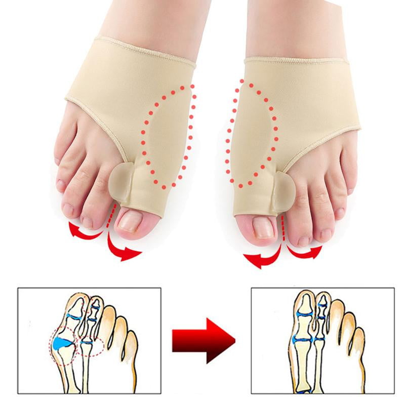 HexoBunion™ Orthopädische Korrektorhülse (1 Paar)