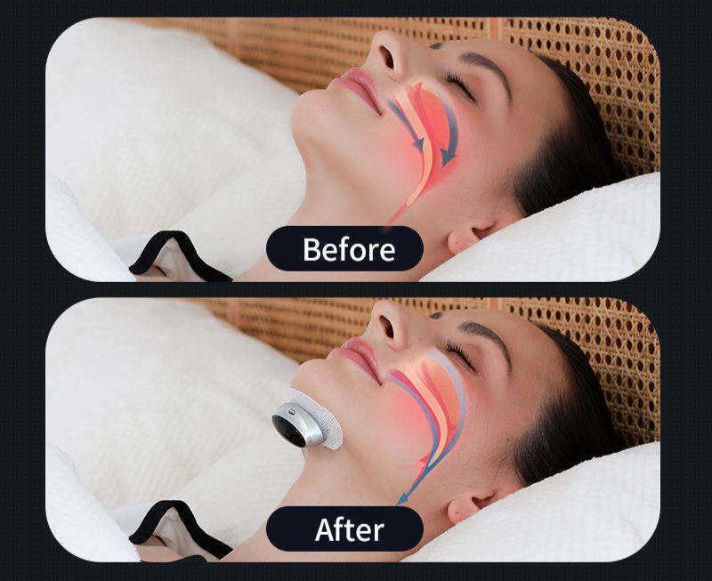 HexoSleep™ Intelligente Schlafapnoe-Hilfe