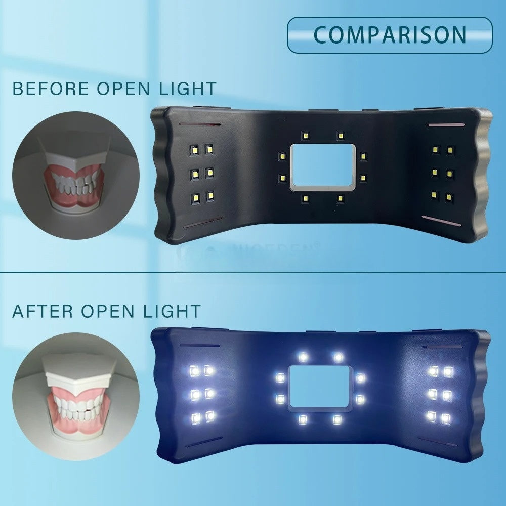 HexoSmile™ – LED-Dentallampe für präzise intraorale Fotografie