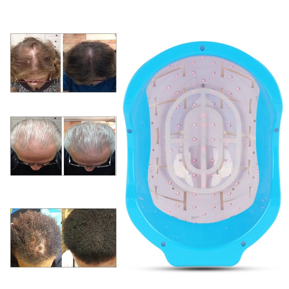 HexoGrow™ - Laser-Haarwuchs-Helm