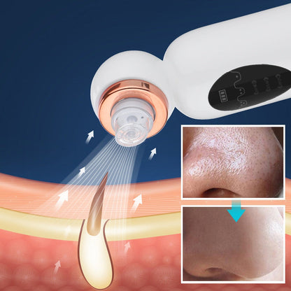 HexoSkin™ Hydrodermabrasion Mitesserentferner