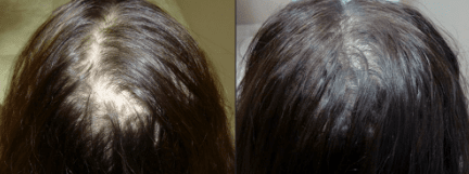 Anti-Haarausfall-Wachstumsserum