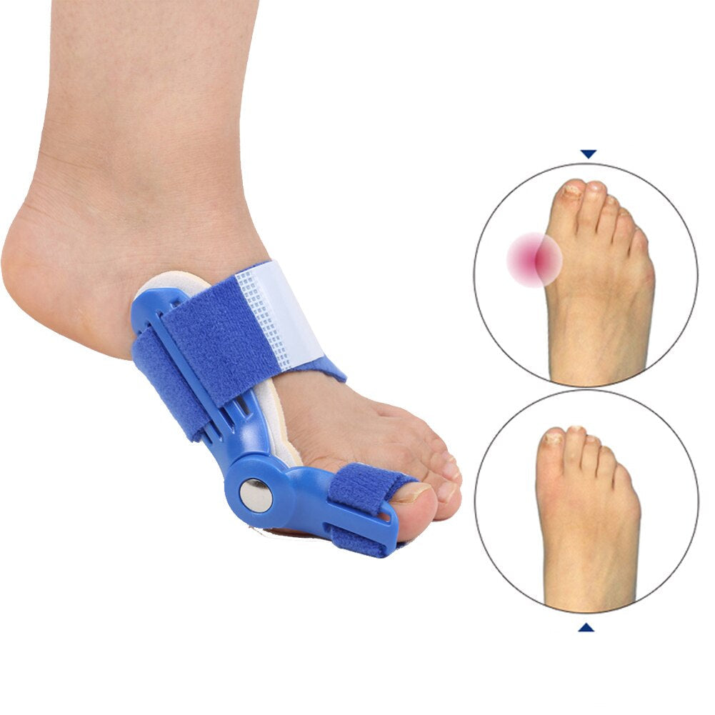 HexoBunion™ Orthopädischer Ballenkorrektor (1 Paar)