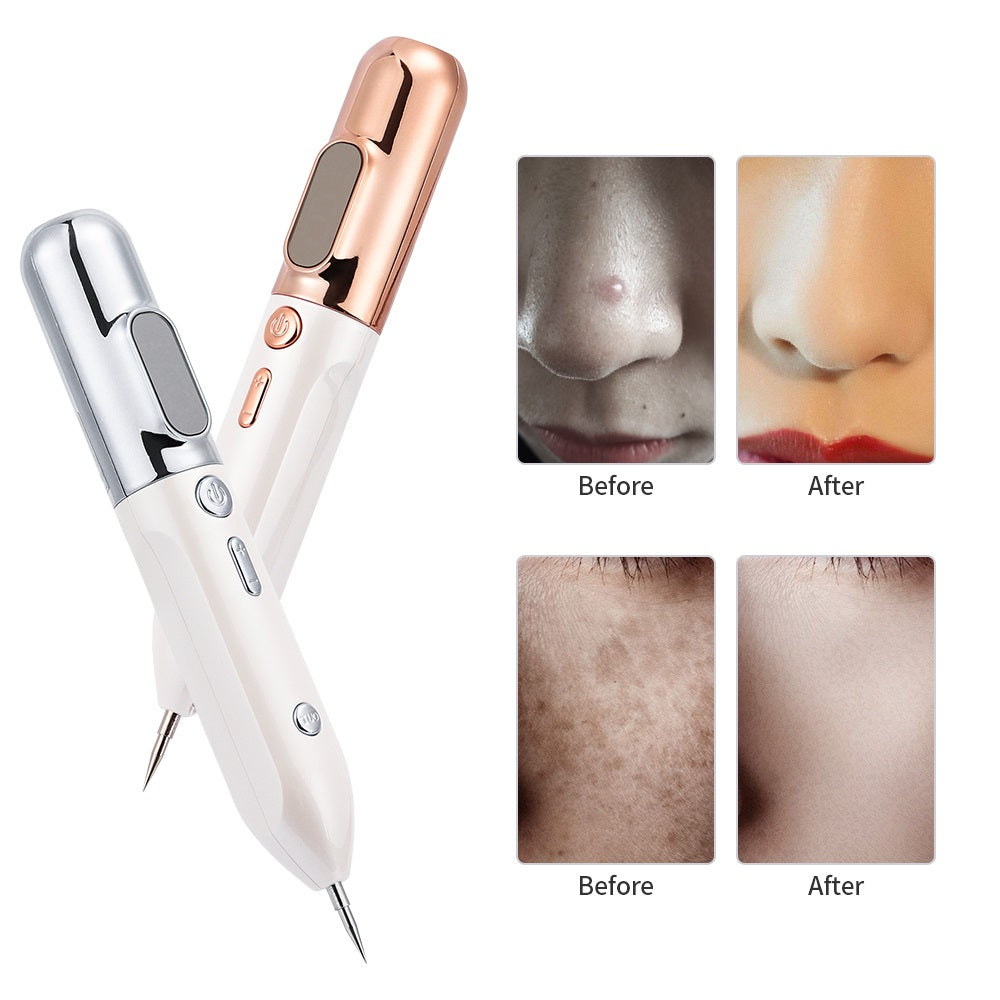 HexoPen™️ PLASMA-STIFT ZUR ENTFERNUNG VON MUTTERMALEN UND HAUTMARKIERUNGEN