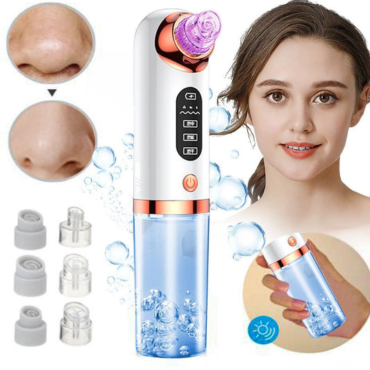 HexoSkin™ Mikrodermabrasion Tiefenreinigender Mitesser-Entferner