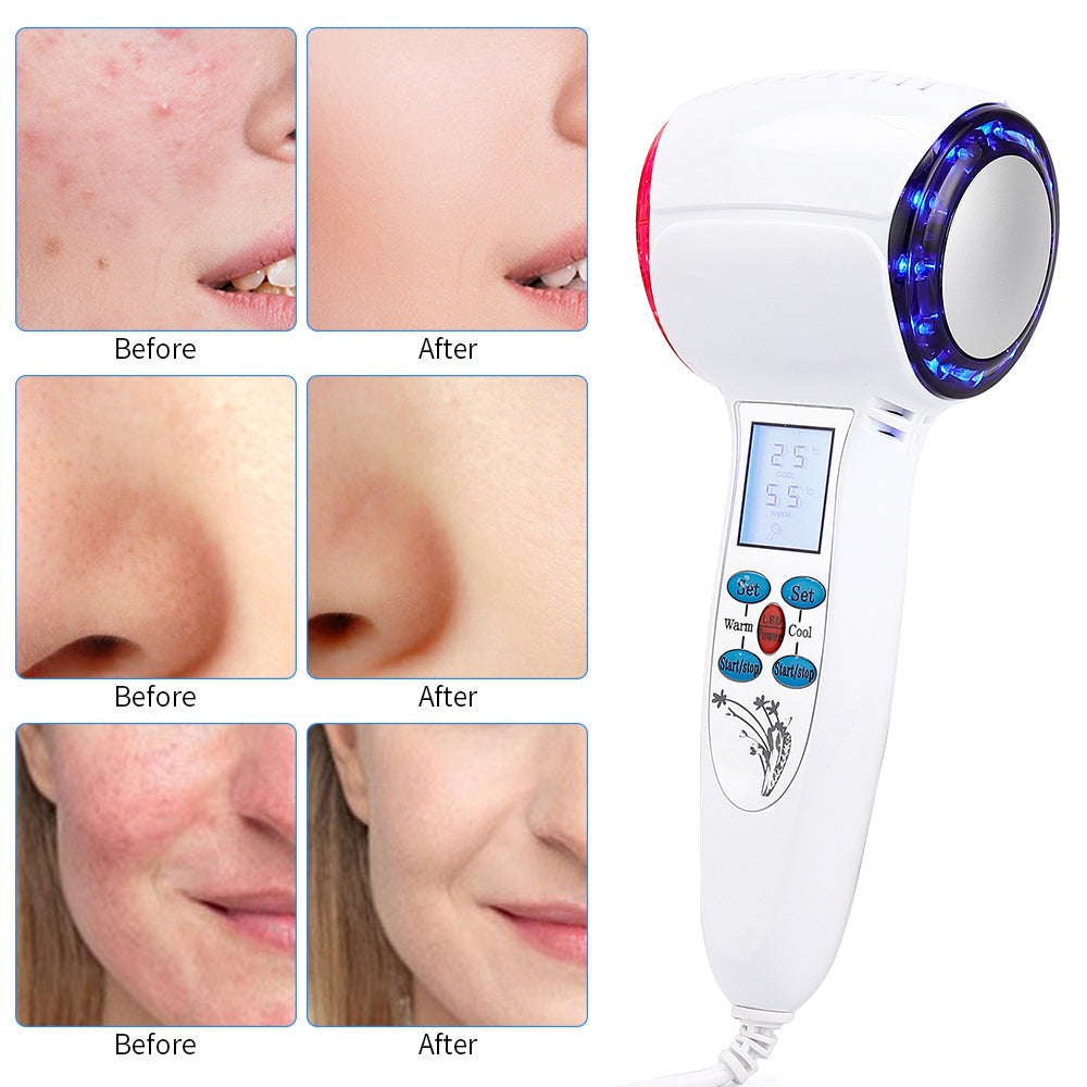 HexoCryo™ Gesichtskryotherapiegerät für zu Hause