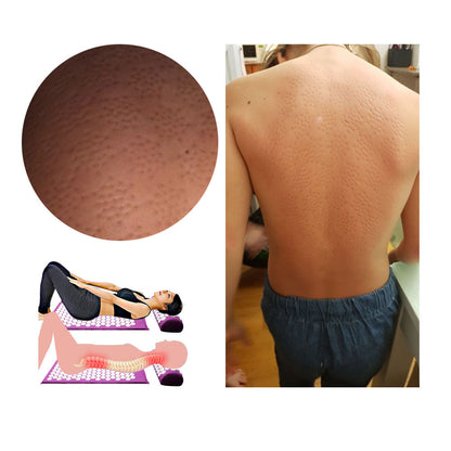 HexoRelief™ - Akupressur Yoga Matte & Kissen Set