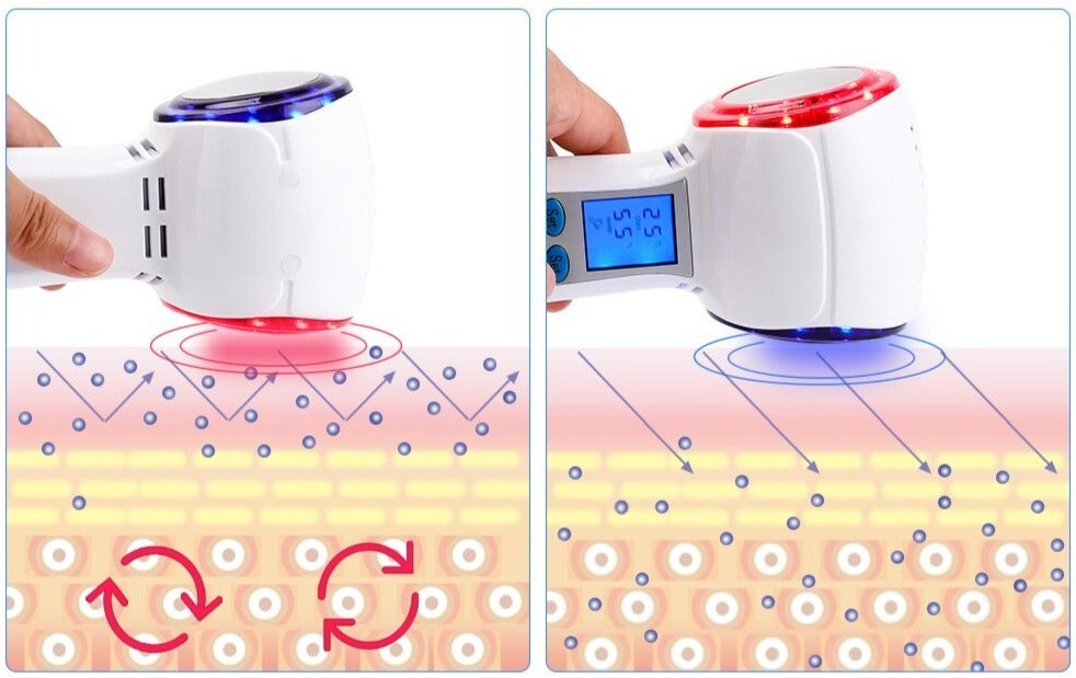 HexoCryo™ Gesichtskryotherapiegerät für zu Hause