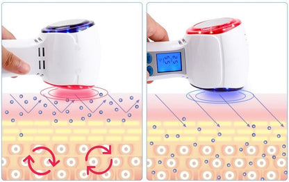 HexoCryo™ Gesichtskryotherapiegerät für zu Hause